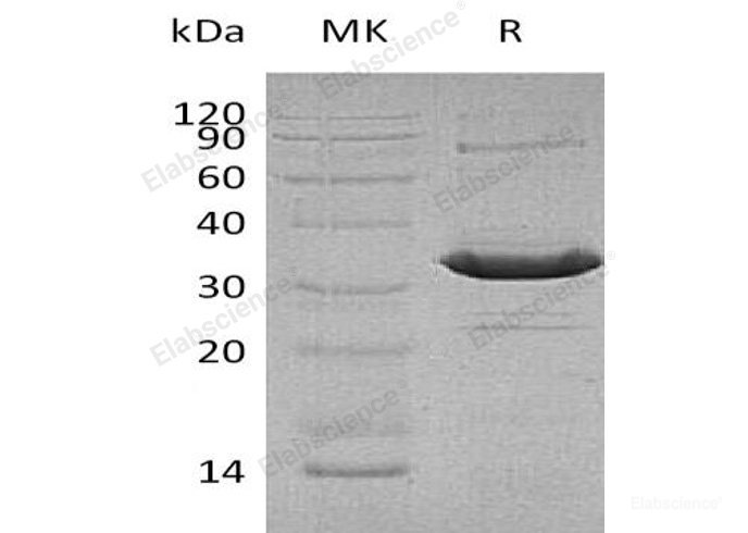 Recombinant Human Activating Transcription Factor 1/ATF1 Protein(C-6His)-Elabscience