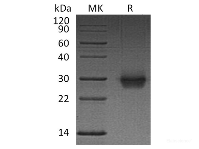 Recombinant Human Activin Receptor 2B/Activin RIIB/ACVR2B Protein(C-6His)-Elabscience
