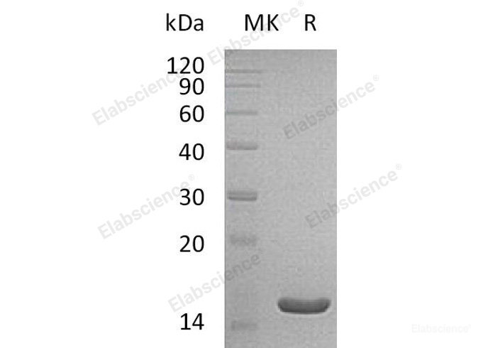 Recombinant Human Acyl-Coenzyme A Thioesterase 13/ACOT13 Protein(C-6His)-Elabscience