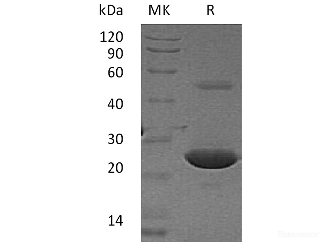 Recombinant Human Acyl-Protein Thioesterase 1/APT-1 Protein(N-6His)-Elabscience