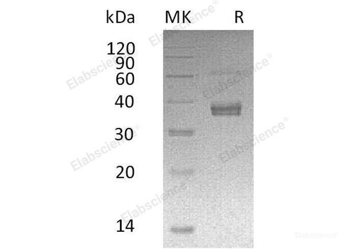 Recombinant Human ADAM-like Protein Decysin-1/ADAMDEC1 Protein(C-6His)-Elabscience