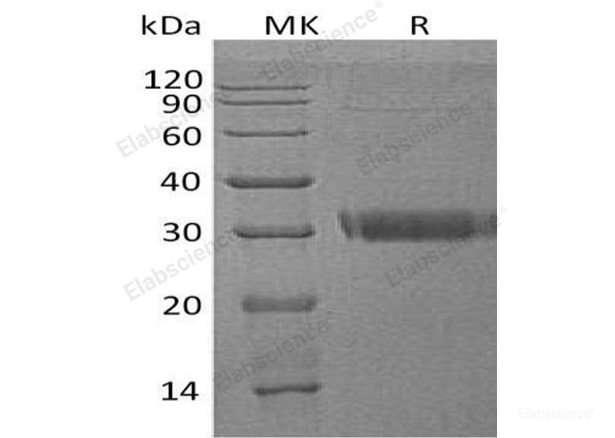 Recombinant Human Adiponectin/ACRP30/ADIPOQ Protein(C-6His)-Elabscience