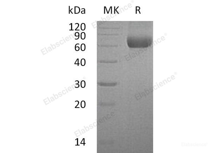 Recombinant Human Airway Trypsin-Like Protease 5/HATL5/TMPRSS11B Protein(C-6His)-Elabscience
