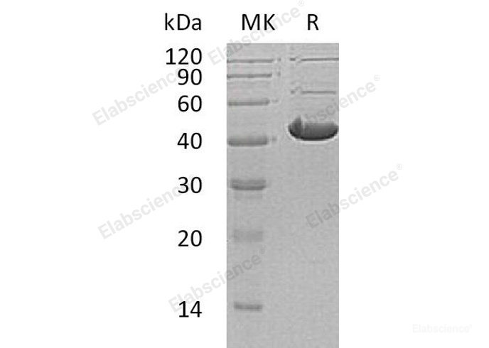 Recombinant Human Alcohol Dehydrogenase Class 4 Mu/ADH7 Protein(C-6His)-Elabscience