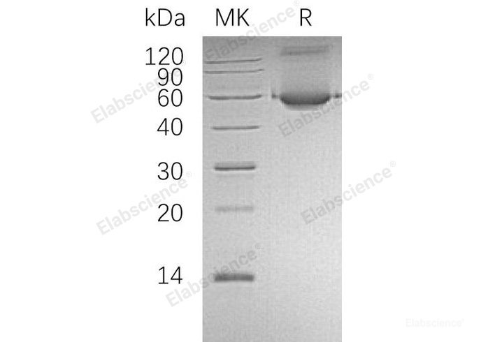 Recombinant Human Aldehyde Dehydrogenase 1-A1/ALDH1A1 Protein(N-6His)-Elabscience