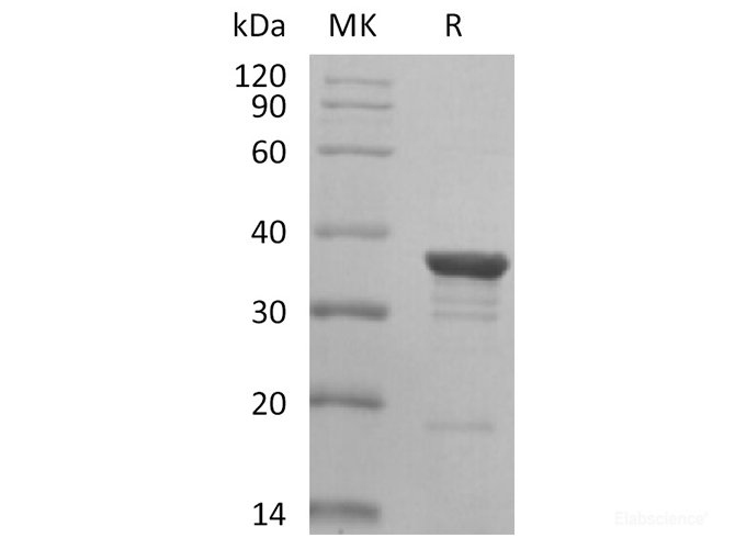 Recombinant Human Aldo-Keto Reductase 1C2/AKR1C2 Protein-Elabscience