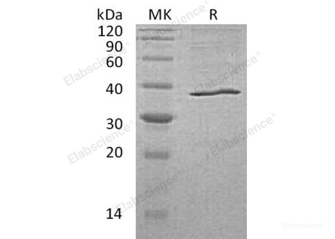 Recombinant Human Aldo-Keto Reductase 1C3/AKR1C3 Protein(C-6His)-Elabscience
