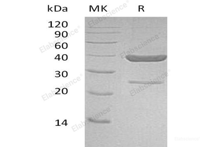 Recombinant Human Aldo-Keto Reductase 1C4/AKR1C4 Protein(N-6His)-Elabscience