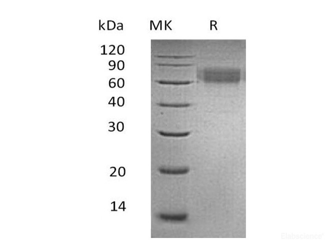 Recombinant Human Ameloblastin/AMBN Protein(C-6His)-Elabscience