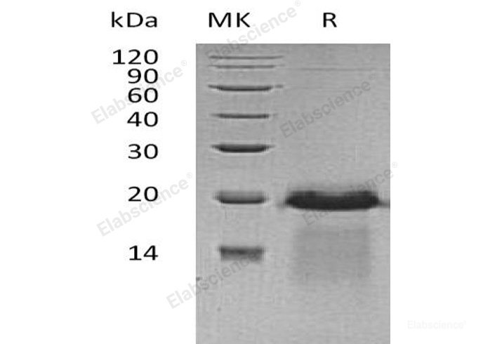 Recombinant Human Amyloid β A4 Precursor Protein-Binding A3/APBA3/X11-γ Protein(C-6His)-Elabscience