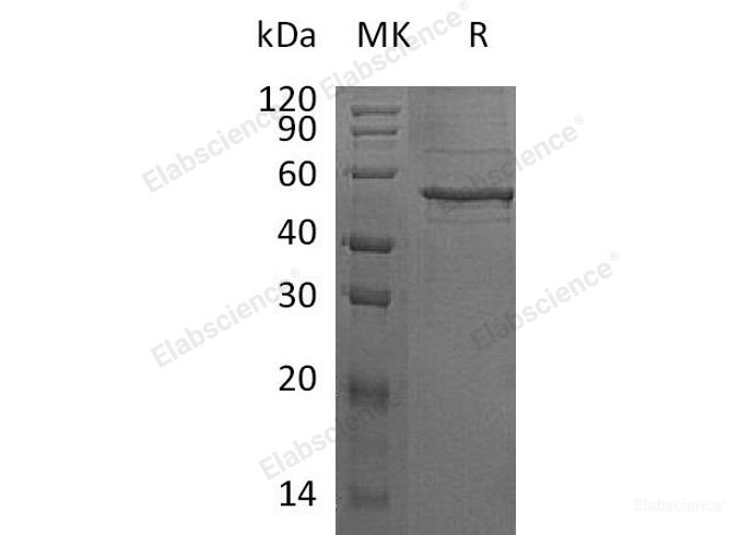 Recombinant Human Angiopoietin-Like Protein 8/ANGPTL8/βtrophin Protein(N-Fc)-Elabscience