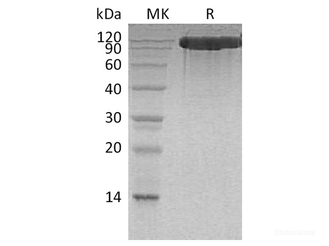 Recombinant Human Angiotensin-Converting Enzyme 2/ACE-2 Protein(C-6His)-Elabscience