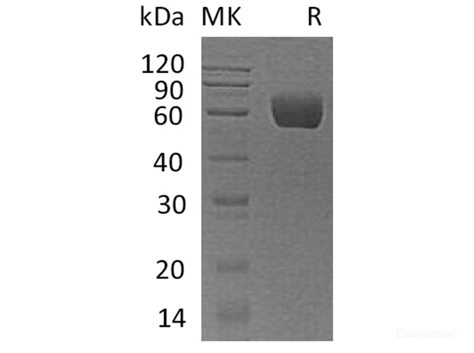 Recombinant Human Angiotensinogen/Serpin A8/AGT Protein(C-6His)-Elabscience