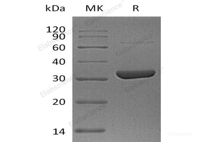 Recombinant Human Annexin A10/ANXA10 Protein-Elabscience