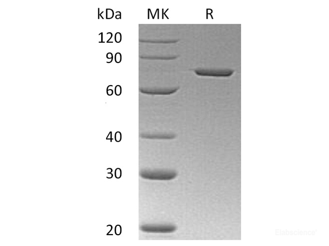 Recombinant Human Annexin A6/ANXA6 Protein(C-6His)-Elabscience