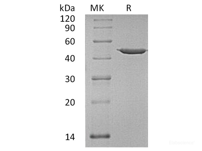 Recombinant Human Annexin A7/ANXA7 Protein-Elabscience