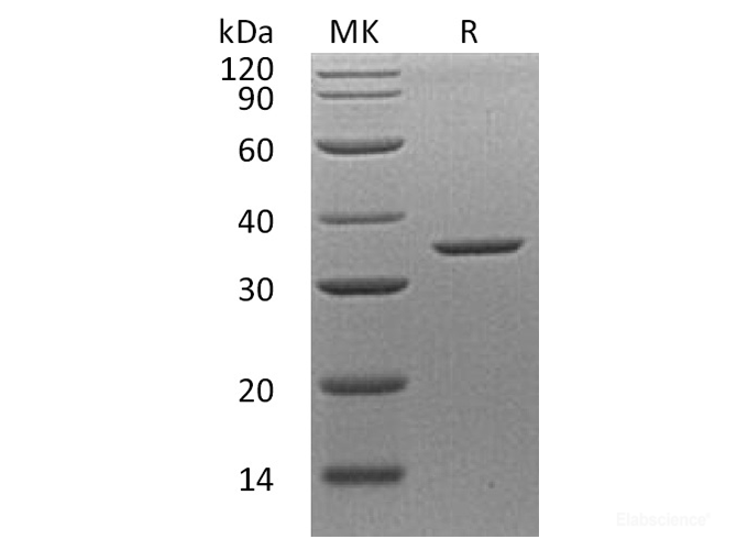 Recombinant Human Annexin A8/ANXA8 Protein-Elabscience