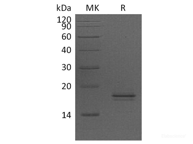 Recombinant Human Anterior Gradient Protein 2 Homolog/AG-2/HPC8/AGR2 Protein(C-6His)-Elabscience