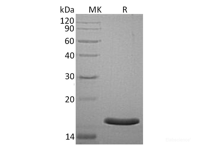 Recombinant Human Anterior Gradient Protein 3 Homolog/AG-3/BCMP11/AGR3 Protein(C-6His)-Elabscience