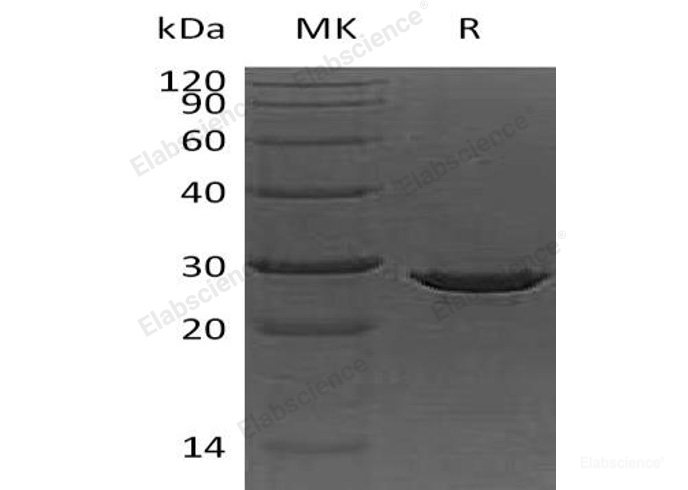 Recombinant Human Apolipoprotein A1/ApoA1 Protein(C-6His, E. coli)-Elabscience