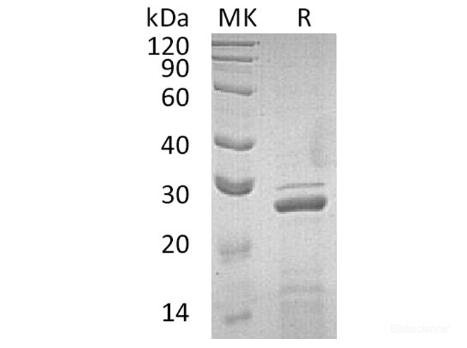 Recombinant Human Apolipoprotein A-I/APOA1) Protein-Elabscience