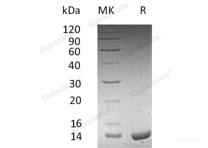 Recombinant Human Apolipoprotein C-II/APOC2 Protein(C-6His)-Elabscience