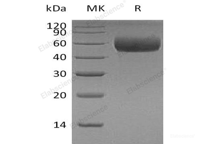 Recombinant Human Apolipoprotein H/ApoH Protein(C-6His)-Elabscience