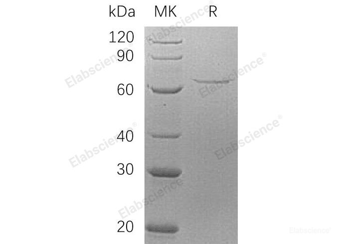 Recombinant Human Apoptosis-Inducing Factor 1 Mitochondrial/AIFM1 Protein(N-6His)-Elabscience