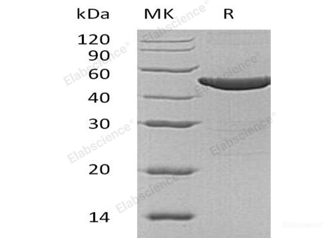 Recombinant Human Argininosuccinate Synthase/ASS1 Protein(N-6His)-Elabscience