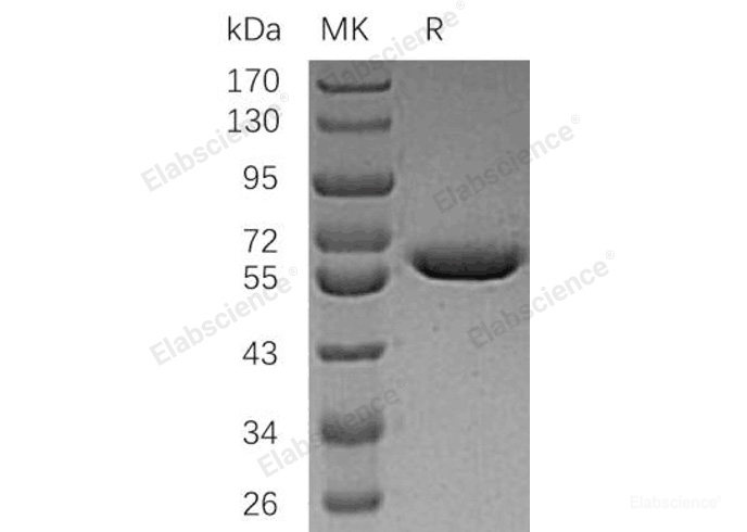 Recombinant Human Arylsulfatase A/ARSA Protein(C-6His)-Elabscience