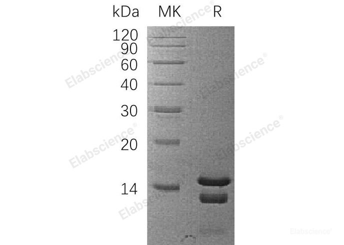 Recombinant Human Astrocytic Phosphoprotein PEA-15/PEA15 Protein-Elabscience
