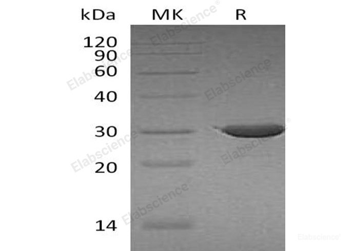 Recombinant Human ATP-binding Cassette B5/ABCB5 Protein(N-Trx)-Elabscience