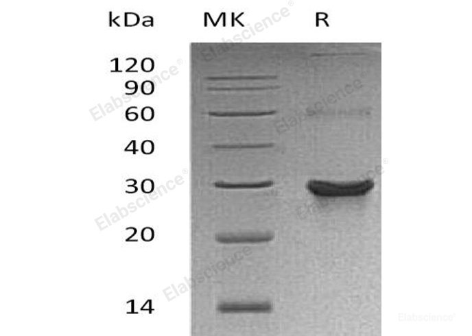 Recombinant Human Autophagy Related 10 Homolog/ATG10 Protein(C-6His, N-T7 tag)-Elabscience