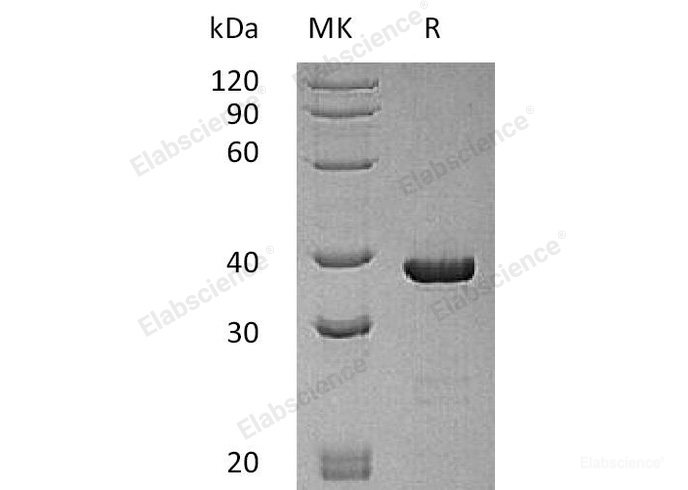 Recombinant Human Autophagy Related 3 Homolog/ATG3 Protein(C-6His, N-T7 tag)-Elabscience