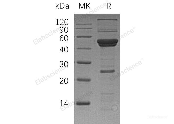 Recombinant Human Autophagy Related 4 Homolog A/ATG4A Protein(N-6His)-Elabscience