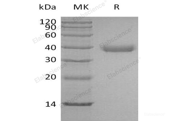 Recombinant Human Azurocidin/CAP37/HBP Protein(C-6His)-Elabscience