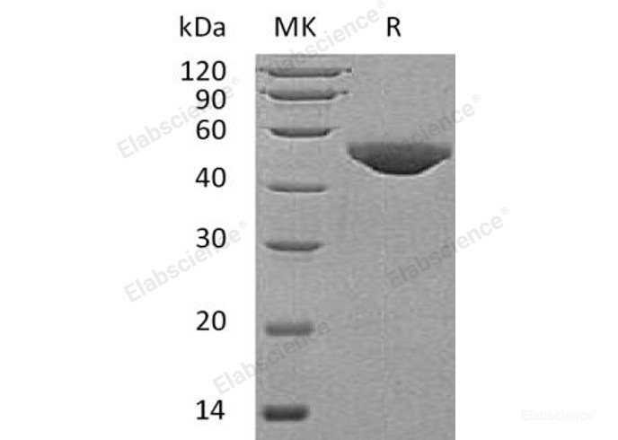 Recombinant Human B3GNT1 Protein(C-6His)-Elabscience