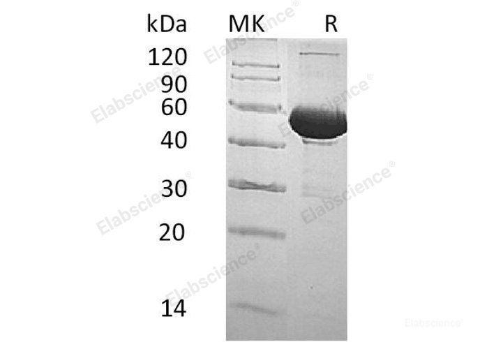 Recombinant Human Bactericidal Permeability-Increasing Protein/BPI/CAP57 Protein(C-6His)-Elabscience