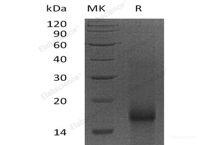 Recombinant Human Baculoviral IAP Repeat-Containing Protein 5/BIRC5/Survivin Protein-Elabscience
