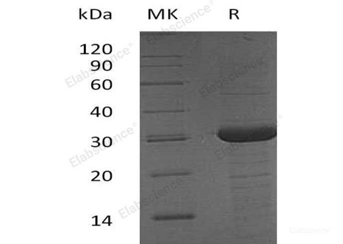 Recombinant Human BCAS2/DAM1 Protein(C-6His, N-T7 tag)-Elabscience