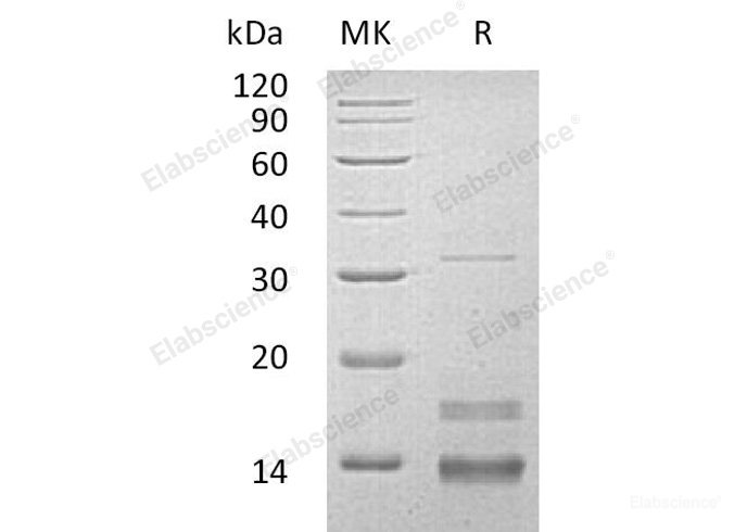 Recombinant Human B-Cell Differentiation Antigen CD72/Lyb-2 Protein(N-Trx, 6His)-Elabscience