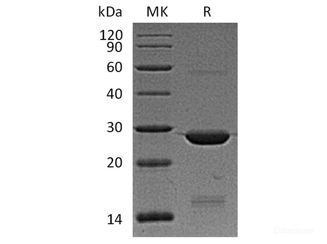 Recombinant Human Bcl-2-Associated Athanogene 1/BAG2 Protein(N-6His)-Elabscience