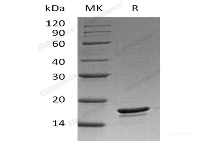 Recombinant Human Bcl-2-Llike Protein 2/BCL2L2 Protein(C-6His)-Elabscience