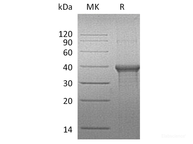 Recombinant Human Biliverdin Reductase A/BVR A Protein(C-6His)-Elabscience