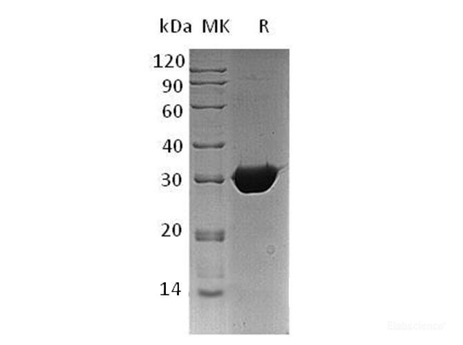 Recombinant Human Bisphosphoglycerate Mutase/BPGM Protein(C-6His)-Elabscience