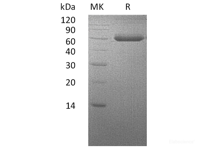 Recombinant Human BMP Receptor IA/ALK-3/CD292 Protein(C-Fc-6His)-Elabscience