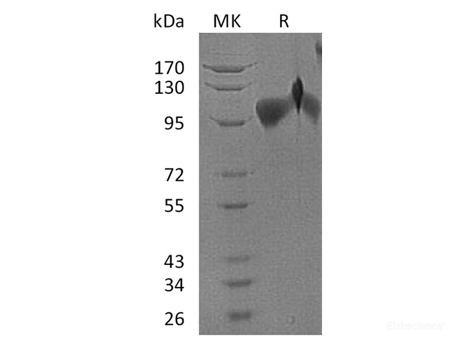 Recombinant Human BMP Receptor II/BMPR2/PPH1 Protein(C-Fc-6His)-Elabscience