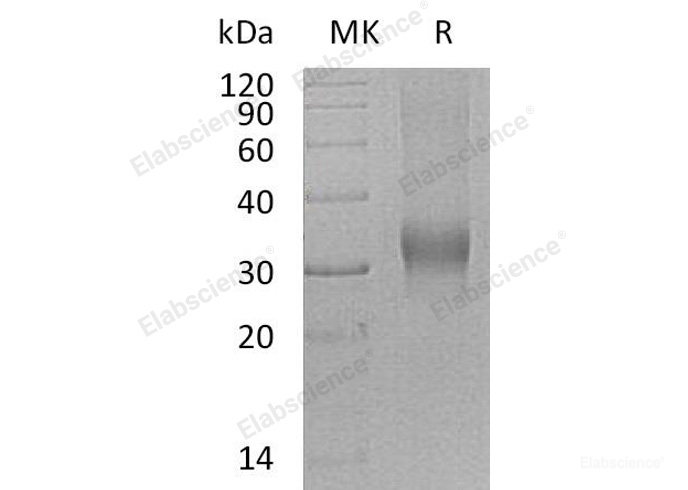 Recombinant Human Bone Marrow Proteoglycan/BMPG Protein(C-6His)-Elabscience