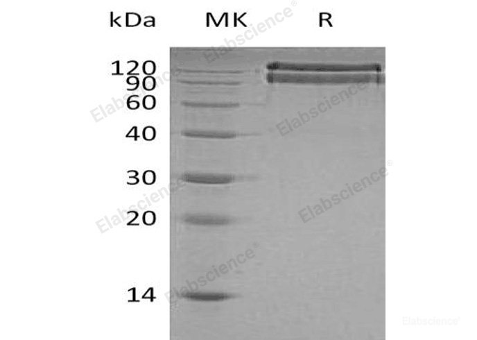 Recombinant Human Brain-Specific Angiogenesis Inhibitor 3/BAI3 Protein(C-6His)-Elabscience