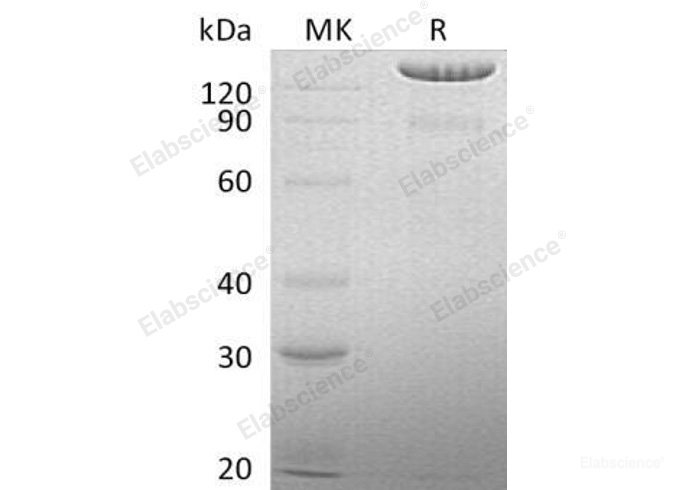 Recombinant Human Brevican Core Protein/BCAN/BEHAB Protein(C-6His)-Elabscience